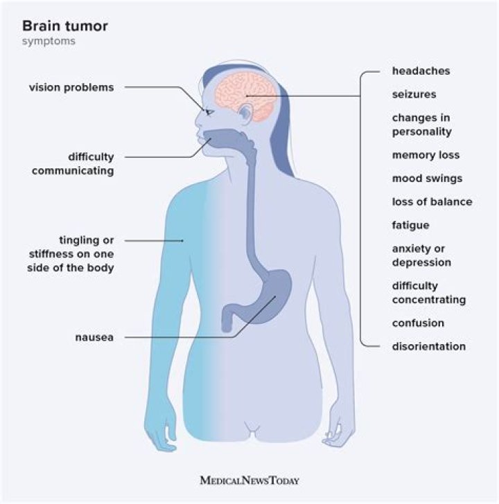 Has The Quartermaine Brain Curse Struck Again-Does Drew Have A Brain Tumor?